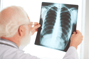 Tahun 2022,Indonesia peringkat kedua dunia pengidap Tuberclosis