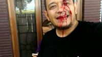 Jurnalis Di Probolinggo Dianiaya Oknum LSM Setelah Pemberitaan Tambang Ilegal